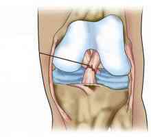 Разрушаване на връзките на колянната става: защо се случва това и как да се премахне?