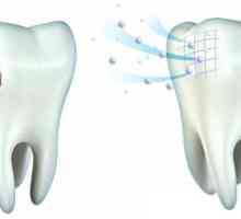 Реминерализация на зъбите у дома: лекарства