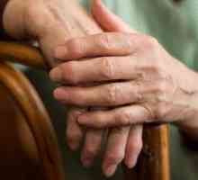 Ревматоиден артрит на пръстите: първите симптоми, причините и лечението