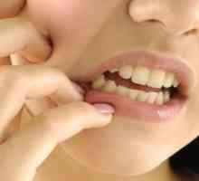 Зъбът е отрязан: симптоми и признаци