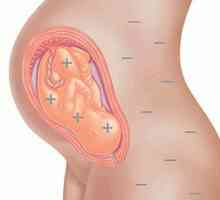 Ресус фактор при планиране на бременността: прегледи