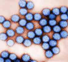Ротавирусна инфекция: симптоми при възрастни и деца, лечение