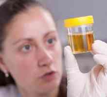 Каква е причината за мътната урина при децата?