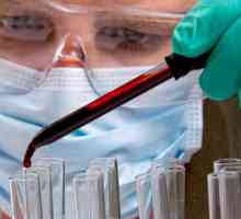 Серологични тестове на кръвта при диагностициране на заболявания