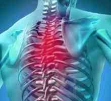 Остеохондроза на гръдния кош: симптоми и лечение с лекарства