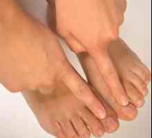 Симптомите на гъбичките на ноктите по краката, характеристиките и сортовете