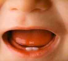 Симптомите на зъбните зъби при деца: Заслужава ли да се тревожите за родителите?