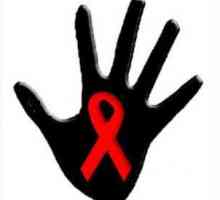 Симптоми на ХИВ инфекцията при жените и мъжете