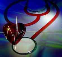 Синдром на артериална хипертония: причини, симптоми, диагноза и лечение