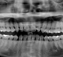 Колко канали в зъба на горната и долната челюсти?