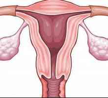 Спазми в матката: възможни причини, описание и характеристики на лечението