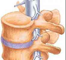Spina bifida - какво е това? Малформация на гръбначния стълб