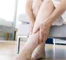 Отстраняване на подуване: мехлем от подуване на краката