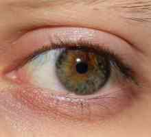 Сухи очи: причини и лечение на народни средства и капки
