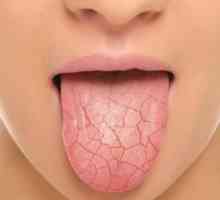 Сухота в устата: причини и елиминиране