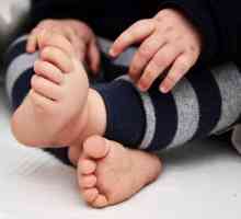 Обрив върху дланите и краката на дете и възрастен: причините и лечението