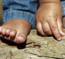 Обрив по дланите и ходилата на детето: възможни причини и характеристики на лечението