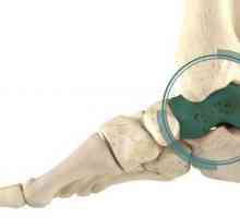 Травматология на крака: анатомия и травма