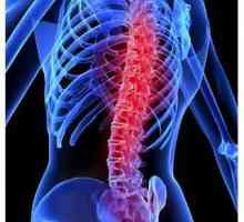 Увреждания на гръбнака: класификация, симптоми, лечение