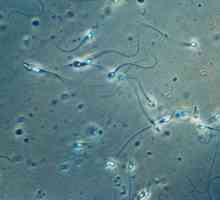 Учените са открили нова структура в сперматозоидите
