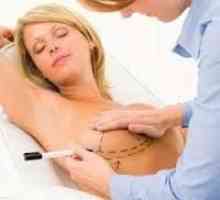 Уголемяване на гърдите: прегледи на различни методи