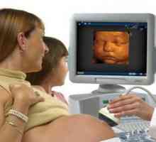 САЩ на 3D по време на бременност