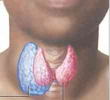 Нодуларен удар на щитовидната жлеза: причини, симптоми и методи на лечение