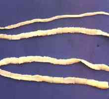 Каква е сходството на плоските и кръгли червеи? Сравнителни характеристики на плоските и кръгли…