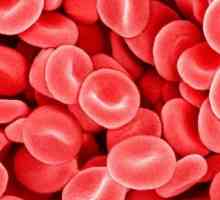 Вие сте загрижени за плътната кръв: причините и лечението