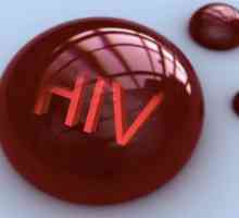 ХИВ: етапите на заболяването