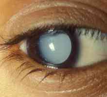 Вита-Йодурол: капки от катаракта