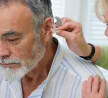 Интраканален слухов апарат: описание, видове, функции и прегледи