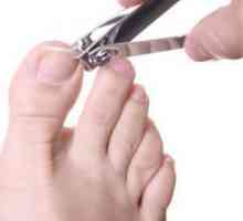 Отглеждане на ноктите на краката: причини и методи на лечение