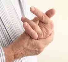 Изместване на пръста на ръка: описание и характеристики на лечението