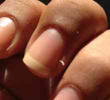 Бръчки на пръстите: причини и лечение