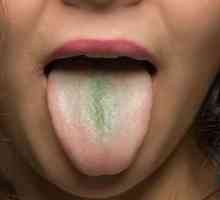 Зелена плака на езика: причините за появата и лечението