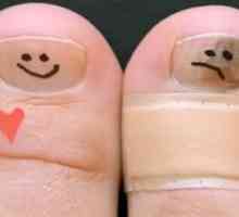 Нездравословна гъба по ноктите на краката: лечение с народни средства