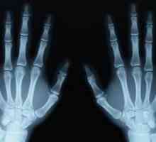 Знаете ли колко често е възможно да вземете рентгенови лъчи и е опасно за човек
