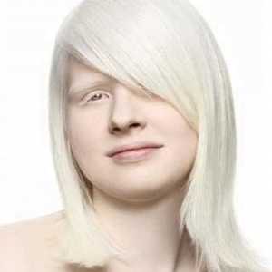 Albinos са ... Албинизмът е вродено отсъствие на пигмента на меланина
