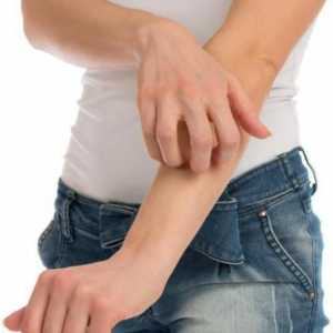 Алергии на краката и ръцете: причините, симптомите и характеристиките на лечението