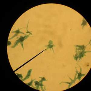 Ameba Proteus: клас, местообитание, снимка. Как се движи амеба протеусът?
