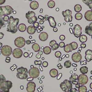 Аморфни кристали в урината: характеристики, декодиране и индекси