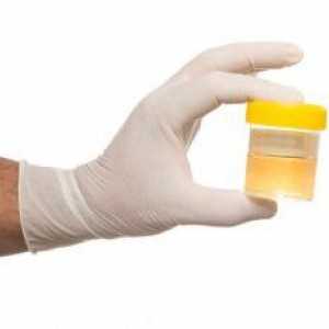 Анализ на урината от Nechiporenko: как да се съберат биоматериали за изследвания?