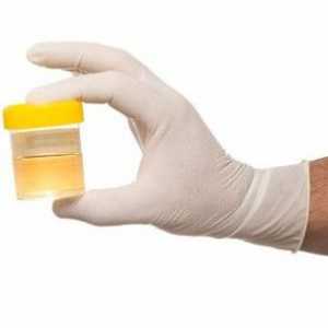 Анализ на урината от Nechiporenko. Как да го сглобим правилно?