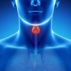 Антителата срещу щитовидната пероксидаза се увеличават. Какво означава това, какво е причинено и…