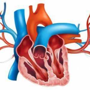 Аортата е уплътнена - какво означава това? Лечение на аортно уплътняване