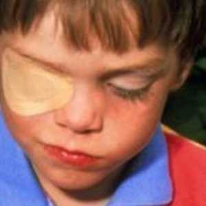 Хардуерно лечение на очите при деца: описание на процедурата, ефективност и обратна връзка