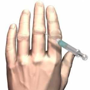 Артрит на пръстите: лечение, причини, симптоми