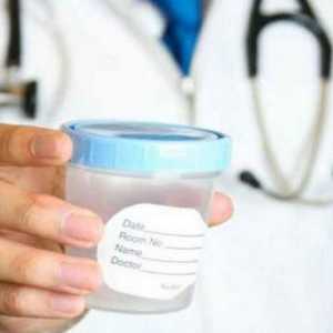 Протеин в урината: лечение с народни средства, причини
