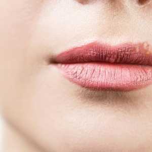 Бели точки върху устните под кожата: снимка как да се лекува